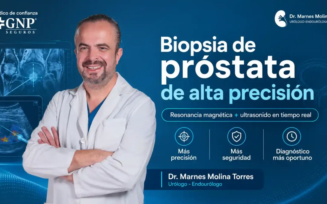 Biopsia de próstata por fusión: cómo combina resonancia y ultrasonido